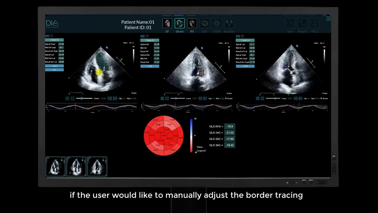 LVivo Seamless™-Enhance Your Echo Lab Workflow