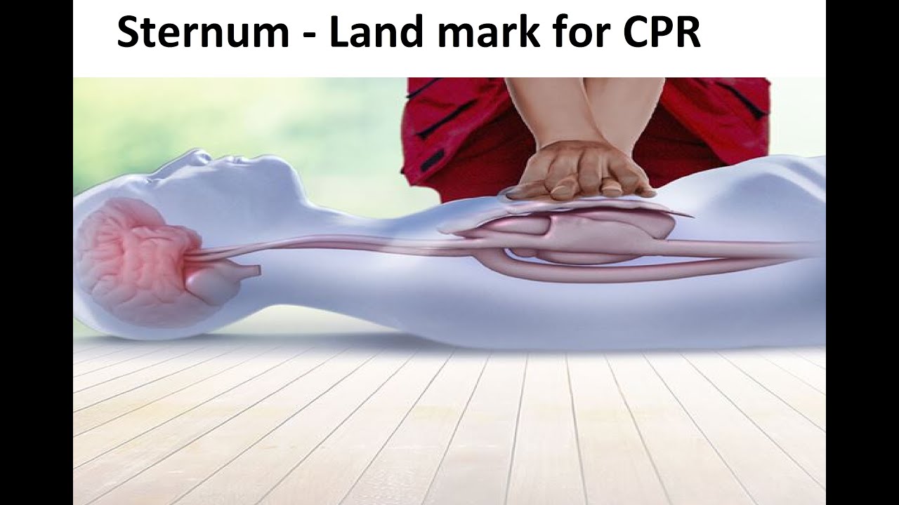 How to do cardiopulmonary resuscitation (CPR) on an Adult Sternum the