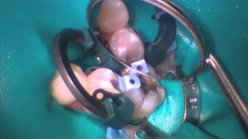 Class II Total Practice Solutions    │Dentsply Sirona