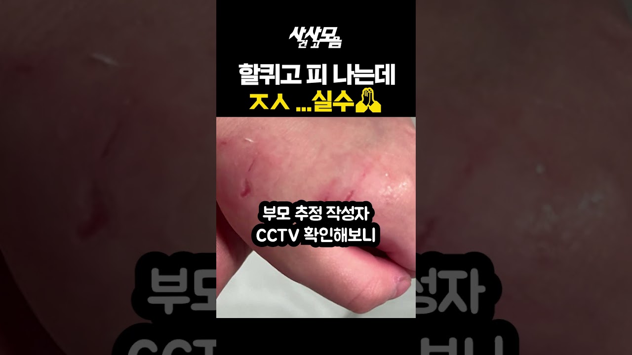 할퀴고 피 나는데 "죄송해요 실수예요" 끝?ㅣ#사사모 #헬로tv뉴스