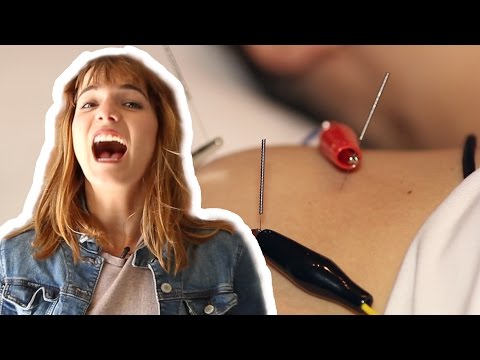 People Try Electroacupuncture For The First Time