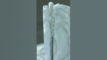 Brain-Computer Interface: No Open Brain Surgery Required #shorts
