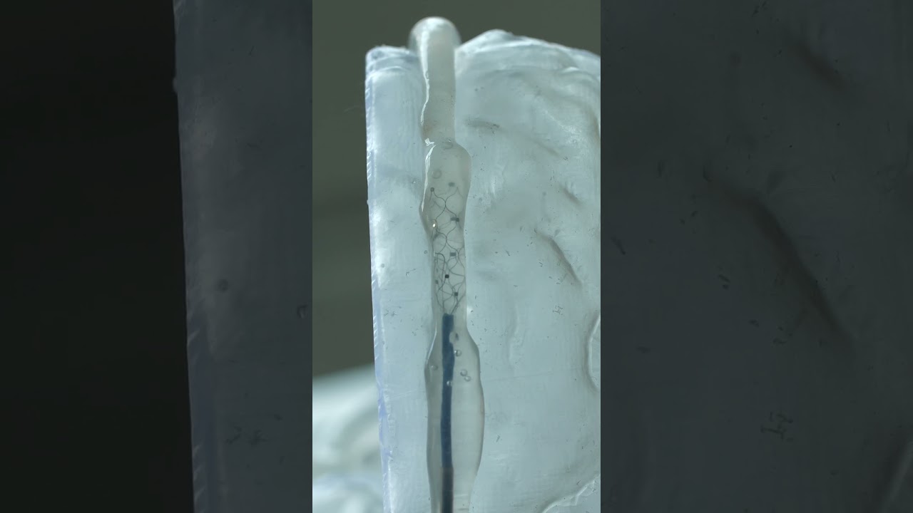 Brain-Computer Interface: No Open Brain Surgery Required #shorts