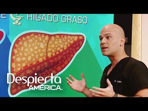 Video: „Hígado Graso“: „Qué Es Y Cómo Salir Del Problema“