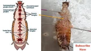 আরশোলার স্নায়ুতন্ত্র ব্যবচ্ছেদকরণ/ Dissection of Nervous system of Cockroach Part- 2