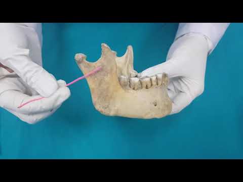 Anatomi Kemikler Ossa Cranii-Viscerocranium Kemikleri-Os Mandibula Anatomisi