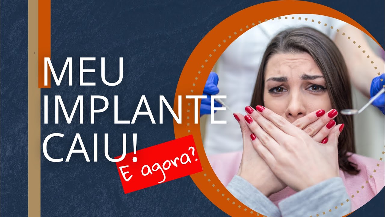 URGENTE: Meu Implante CAIU! Veja o que Aconteceu a Seguir! | Andressa Mezzomo