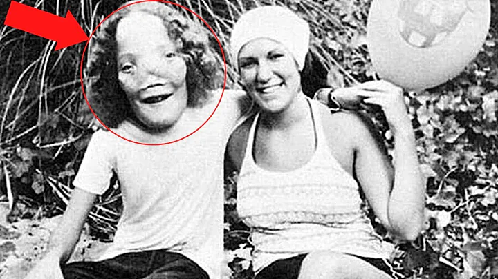 Rocky Dennis The true story of the boy who inspire...