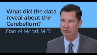 What did the data reveal about the Cerebellum? - Daniel Monti, M.D.