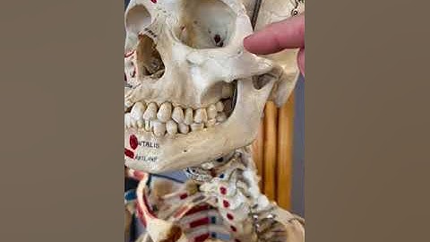 What Are Cheekbones?