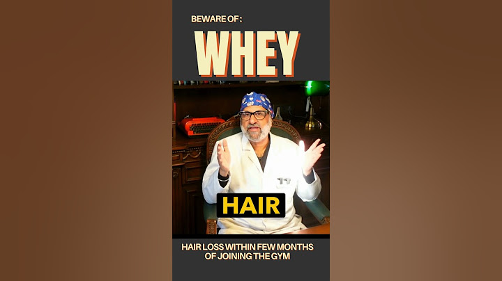 Beware of Whey Protein if you have male pattern baldness!