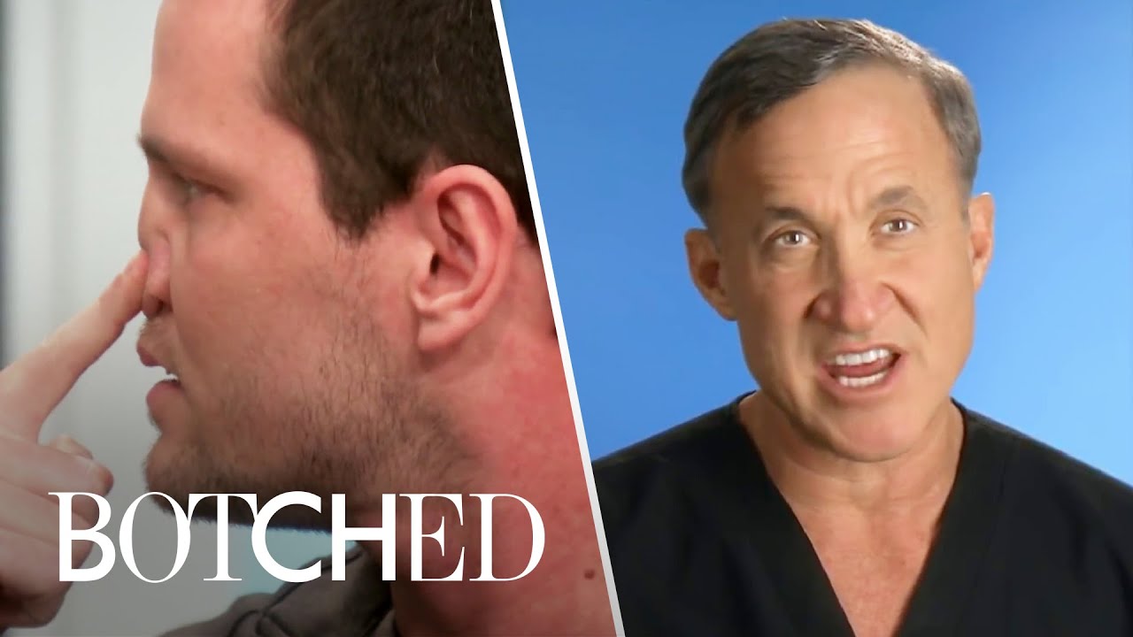 4 Risky Nose Jobs: Brain Leakage & More | Botched