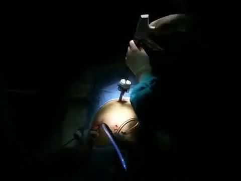 Nội soi túi mật