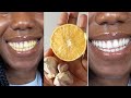 How I whitened  my yellow teeth in 2 Minutes | LIVE DEMO (HOME REMEDY)