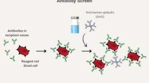 Transfusion medicine Pathology CPT codes - simplify medical coding