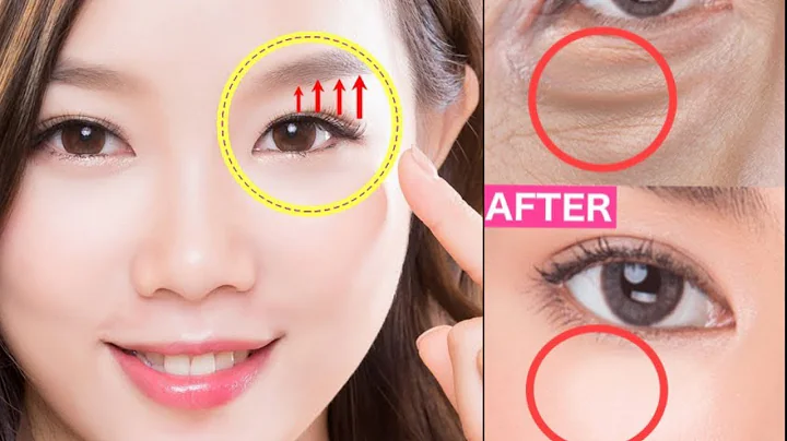 Anti Aging Facial Lifting Exercise For Bigger Eyes, Eye Bags, Droopy Eyelid, Dark Circles Under Eyes