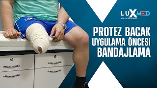 Protez Bacak Uygulama Öncesi Bandajlama Luxmed Protez