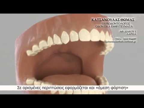 Θωμάς Κατσανούλας – Οδοντικά Εμφυτεύματα