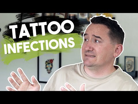 Is My Tattoo Infected?