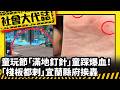 《社會大代誌》童玩節「滿地釘針」童踩爆血！ 「棧板都刺」宜蘭縣府挨轟