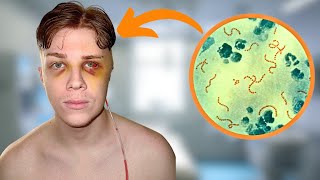 I Have A Brain Infection That Might Kill Me