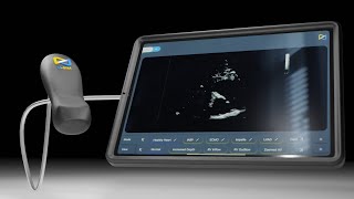 U-SIM POCUS Simulator