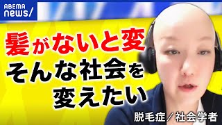 【善意】社会は髪の毛がある前提？ヘアドネーションの功罪は？脱毛症の当事者と考える無意識の差別