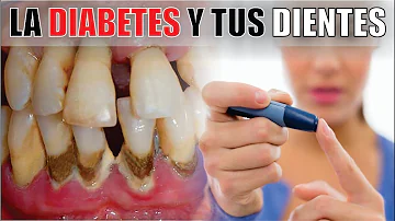 ¿Cómo afecta la diabetes al tratamiento dental?