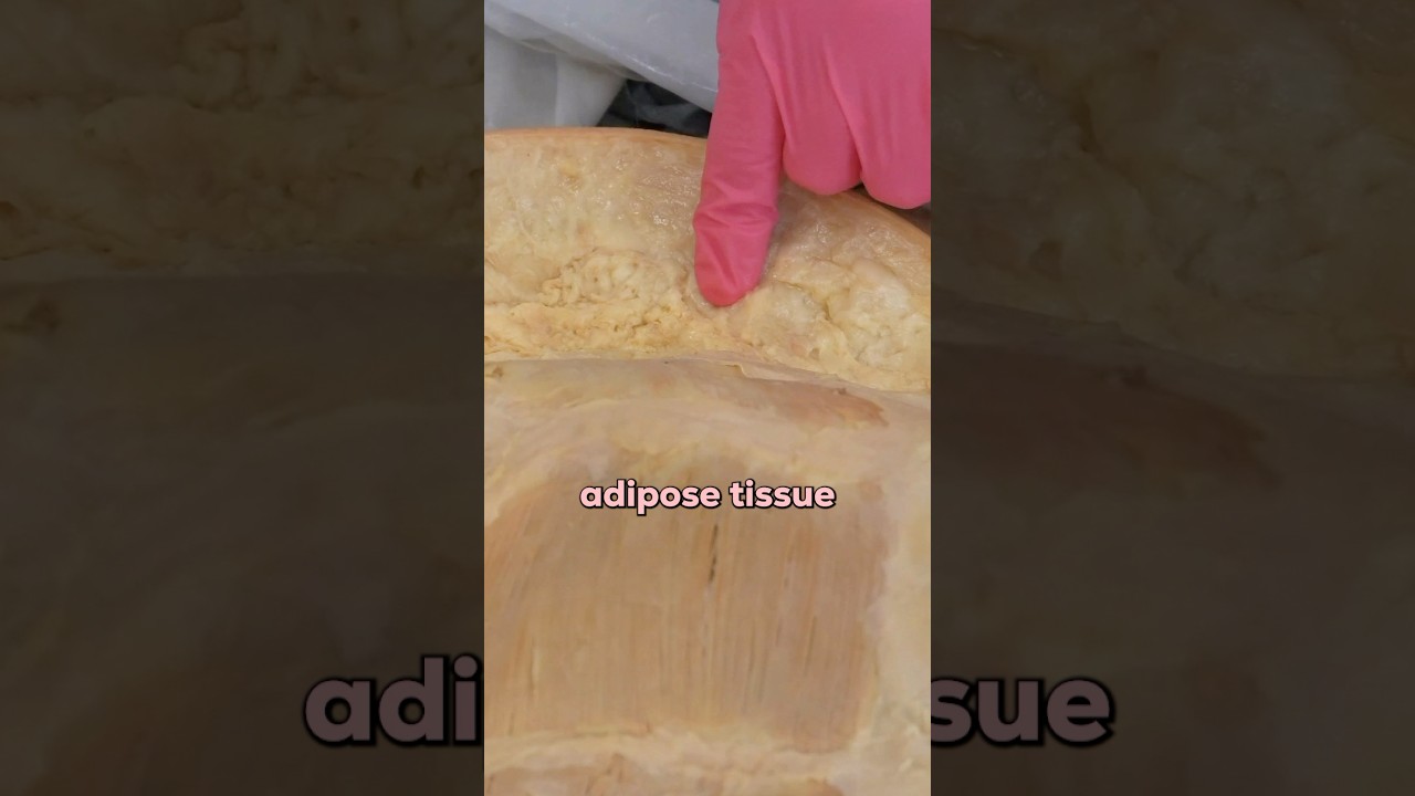 What is the Definition of Obesity?