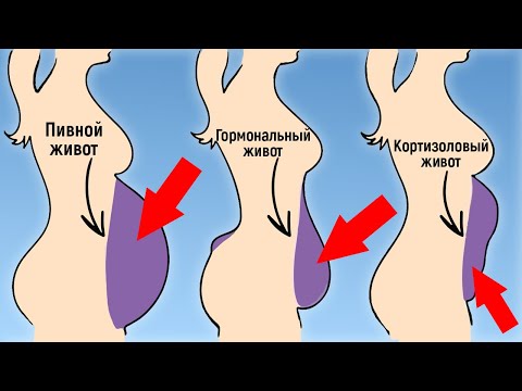 Это заставляет нас ТОЛСТЕТЬ и ТЕРЯТЬ ПАМЯТЬ! / Что за гормон КОРТИЗОЛ?