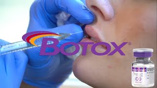 SHOTTi - Botox (visual)