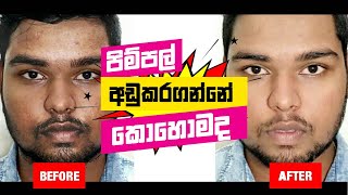 ලේසියෙන්ම මූණ බේරගන්නෙ කොහොමද | How to have a Fair Skin FAST for SL men | mrx | Sinhala