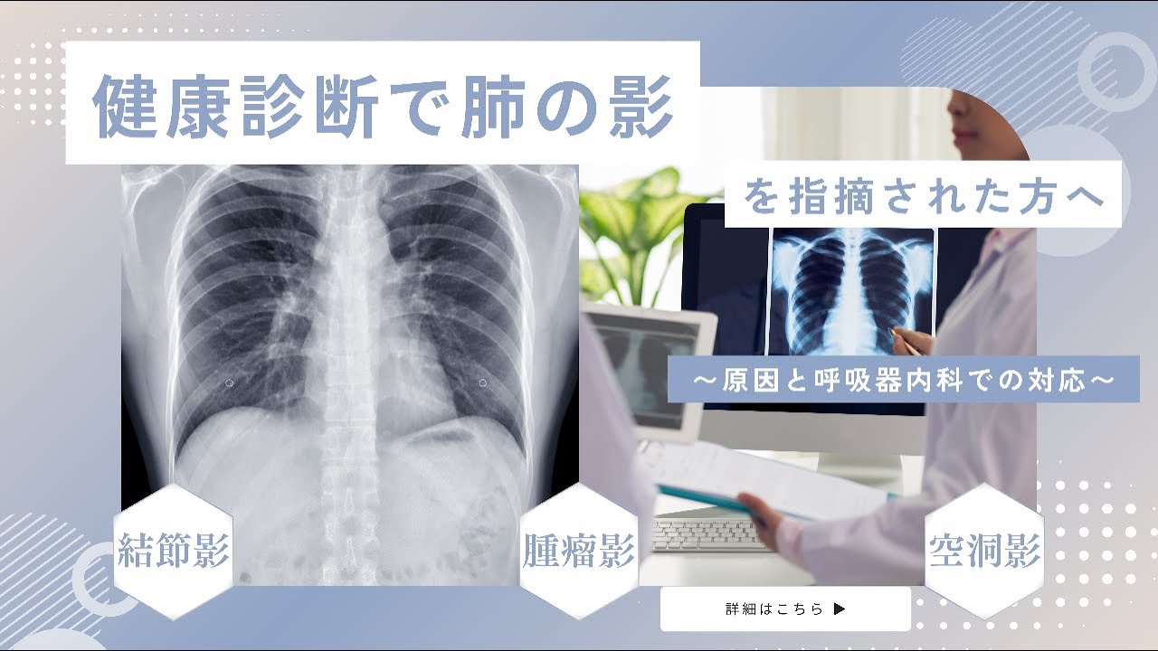 健康診断で「肺に影」って言われた…それ、何のサイン？結節影・空洞影