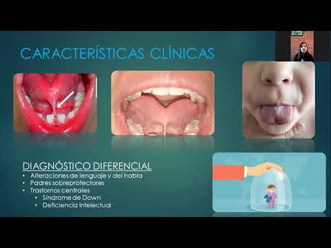 Vídeo: Frenillo Lingual: Tratamiento Y Prevención De Afecciones Anormales