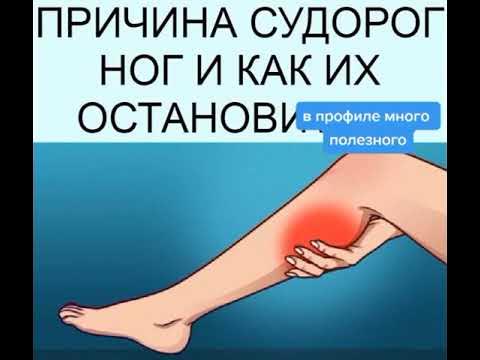 Как выглядит судорога ноги
