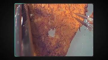 Soft tissue found in dinosaur femur?