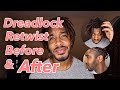 Dreadlock Retwist | Before and After | Drastic Transformation! #dreadlockjourneyy #tplocks