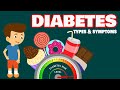 Understanding Diabetes