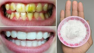 Teeth whitening at home in 3 minutes || How to naturally whiten your yellow teeth || 100% effective