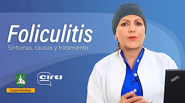 ¿Se puede eliminar la foliculitis de forma permanente?