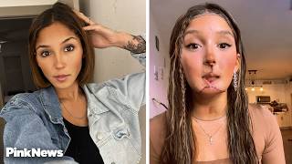 Tiktoker Opens Up About Horrific Incident