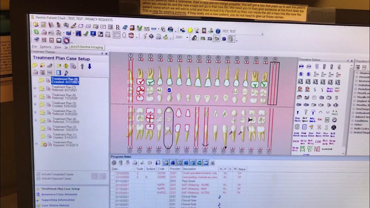 How to scan BWs & PAs Xrays with Dentrix Imaging System YouTube