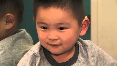 Levi's Story - First Steps with a Prosthetic Leg