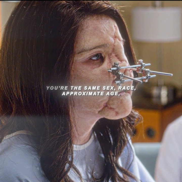 The mother donated her daughter's face to this girl who had suffered severe facial injuries.#edit