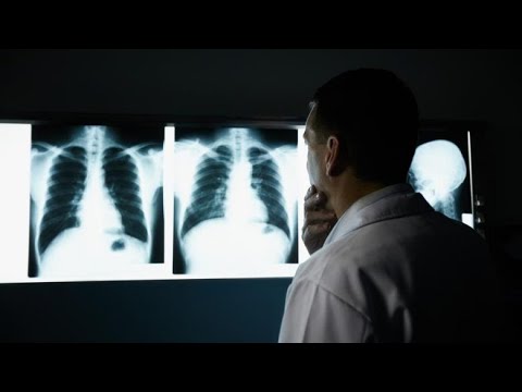 Video: Sa sëmundje të pashërueshme ka?