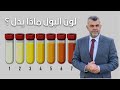 368 ماذا يخبرك لون البول عن جسمك ما هو لون البول الطبيعي 368 ماذا يخبرك لون البول عن جسمك ما هو لون البول الطبيعي