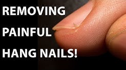 Hang Nail Removal | Quick Manicure Tip to Remove Painful Hang Nails