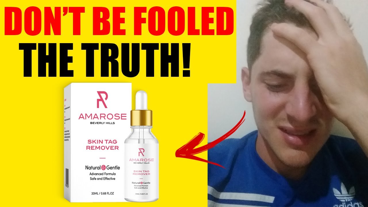 AMAROSE SKIN TAG REMOVER REVIEW Does Amarose Skin Tag Remover Work amarose-skin-tag-remover-review-does-amarose-skin-tag-remover-work