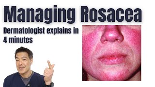 Rosacea Treatments | Tips from a dermatologist