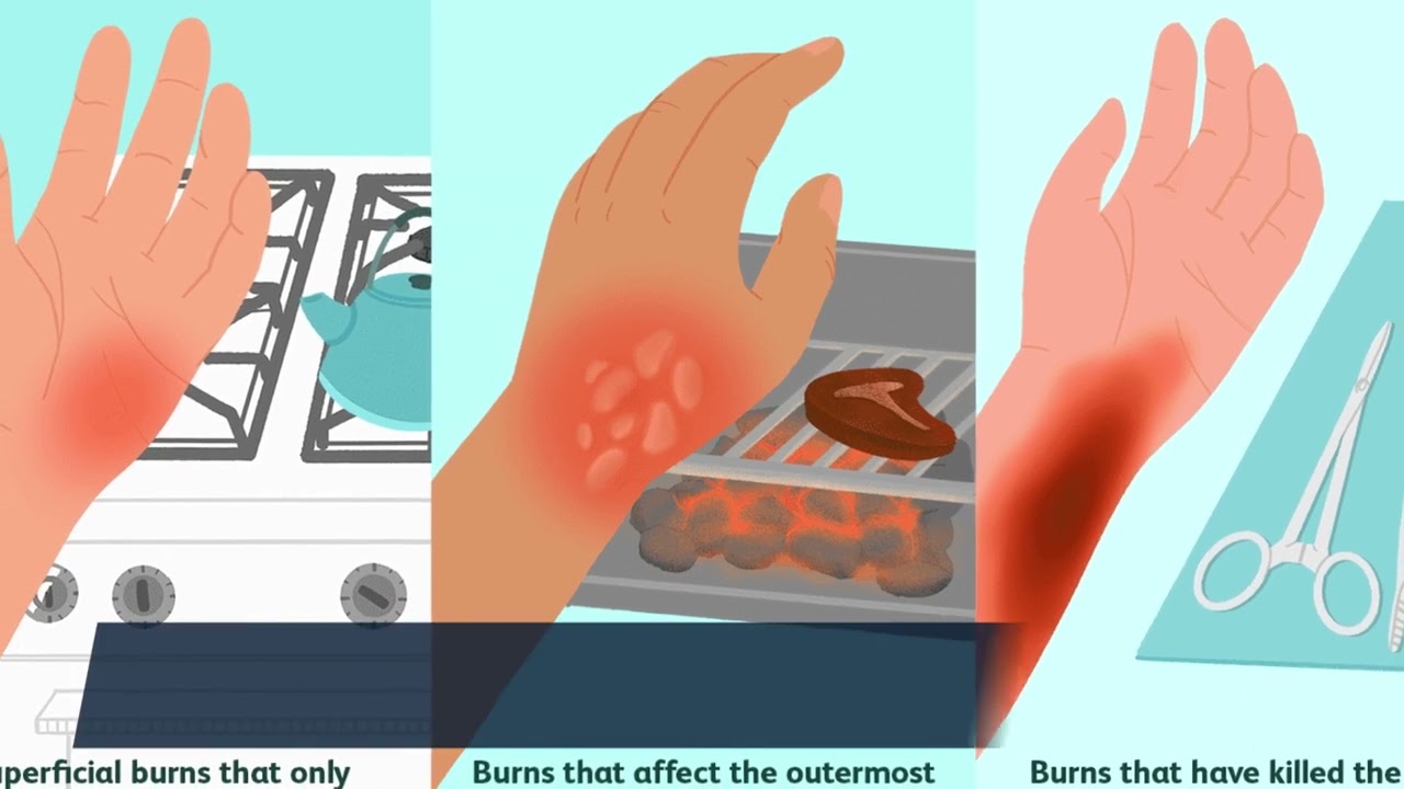 "The Ultimate Detox Solution: Discover the Power of 'Tea Burn' on Its Official Site!"